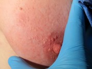 Brennnesseln öffentlich in den BH gestopft - Directors cut 16/16