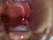 BBW extreme anal and asshole speculum gape 12/16