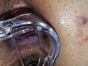 BBW extreme anal and asshole speculum gape 13/16