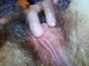 Hirsutism Hairy Fetish Queen Shows sexy Pink Fur Pussy Without a Premise Yum yum 13/16