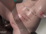 Mercy 02 - Overwatch 9/16