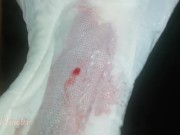 How girs using a sanitary pads during their period days 14/16