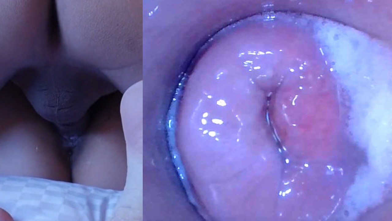 Internal Cumshot Cam - Pussy cum, Pussy cam!! (Endoscope inside creampied pussy) - RedTube