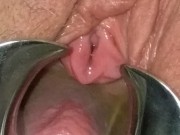 BDSM Pussy Torture Urethral Stretching Medical Fetish Speculum Peehole Play 16/16