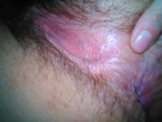 Farting Ass Gas Anal Fart Fetish Slut PinkMoonLust Opens Butthole 4 Stank Asshole Toot 9/16