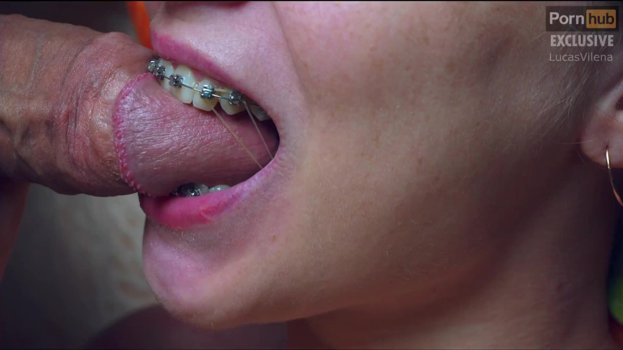 Hot Teen With Braces Do Blowjob And Recieve Cum In Mouth RedTube