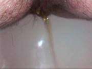 Pipi very close with medical endoscope and small enema all in the ass - Super fetish video