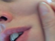PIMPLE POPPING! Spontaneously Orgasming Crazy Camgirl PinkMoonLust Pops Pimples Face & Talks Orgasm 1/16