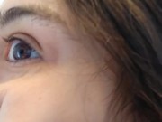 PIMPLE POPPING! Spontaneously Orgasming Crazy Camgirl PinkMoonLust Pops Pimples Face & Talks Orgasm 2/16