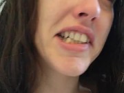 PIMPLE POPPING! Spontaneously Orgasming Crazy Camgirl PinkMoonLust Pops Pimples Face & Talks Orgasm 3/16