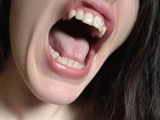 PIMPLE POPPING! Spontaneously Orgasming Crazy Camgirl PinkMoonLust Pops Pimples Face & Talks Orgasm 6/16