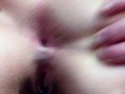 My gaping asshole needs a fat cock up inside 9/16