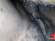 Thot in Texas - Hairy Pretty Titties 5/16