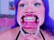 Lila Jordan, suspenders, braces 11/16