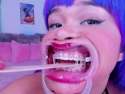 Lila Jordan, suspenders, braces 12/16