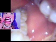 Lila Jordan, suspenders, braces 15/16