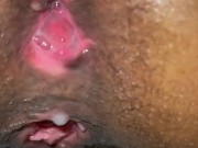 Black Girl Pushes out Anal Creampie 7/16