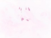 Kinky flexible librarian in glasses enjoys pussy slapping and fingering and squirts 1/16