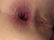 Lanky And Randy! 19yo Teen Cutie Ava Love Has Great Natural Anal Gaping! 15/16