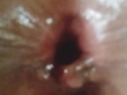 After anal sex pinayflix 11/16