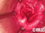 Hot Latina fist fucked in her speculum gaped ass hole 5/16