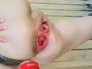 PUBLIC PLAY// ANAL FISTING// PLAY WITH A COKE CAN// EXTREME ANAL INSERTIONS// 9/16