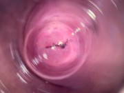 Camera deep inside Mia's teen creamy pussy 10/16