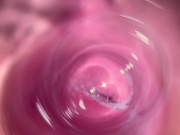 Camera deep inside Mia's teen creamy pussy 8/16